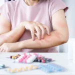 can outdoor allergies cause itchy skin