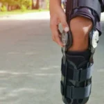 Can You Ride Motocross With Torn ACL And Knee Brace