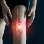 What Causes Knee Hyperextension In Gait