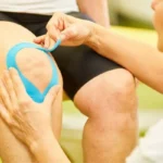 how to tape knee for bursitis