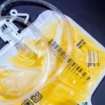 what is a banana bag in medical terms